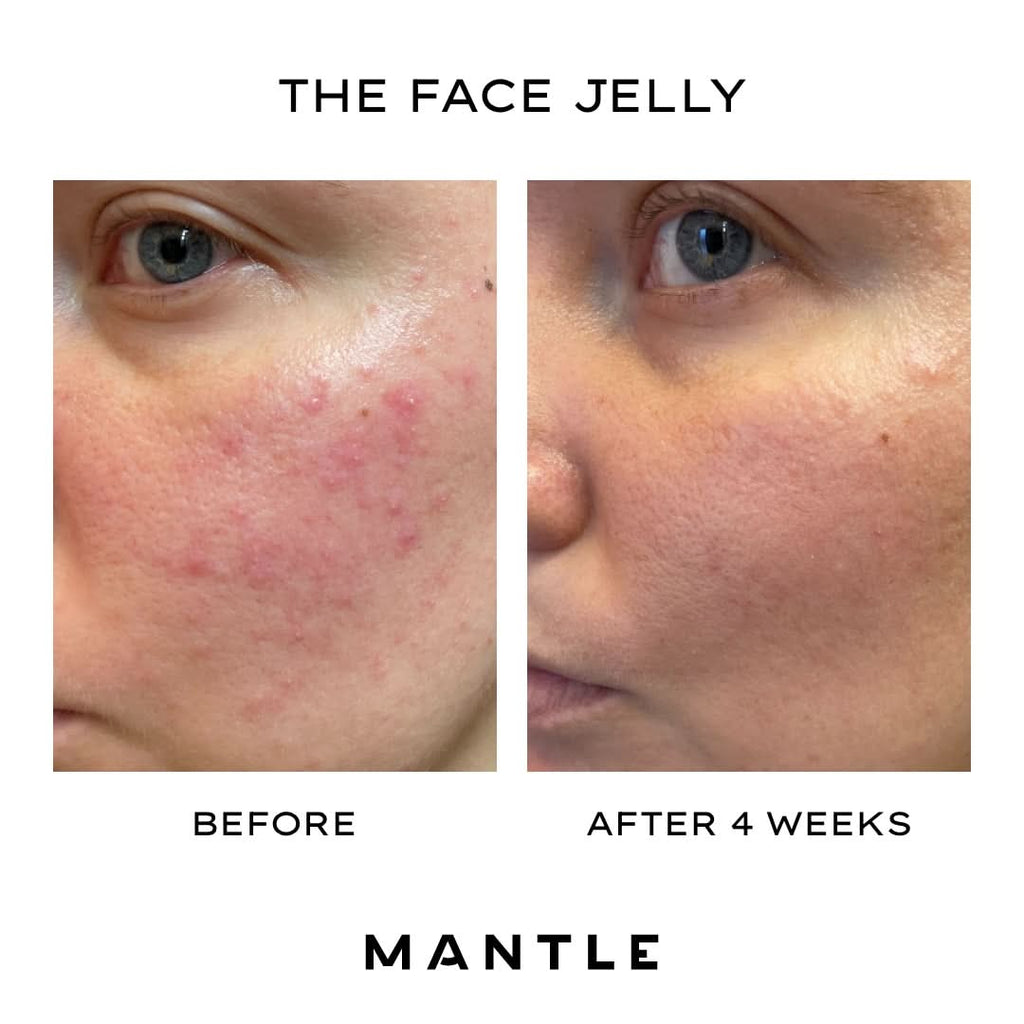 The Face Jelly